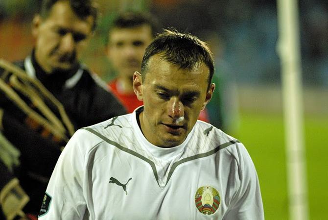 Александру Юревичу соперники разбили лицо, но он все равно продолжил игру